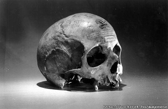 Skull_of_Alexander_Pearce