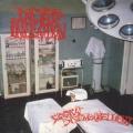 Dead Infection - Surgical Disembowelment LP,Reissue
