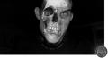 balint skull_o