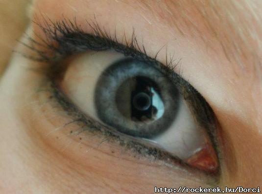 My eye