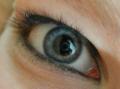My eye