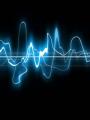beat_line