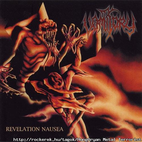 Vomitory