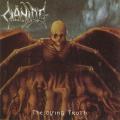 Cianide