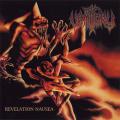 Vomitory