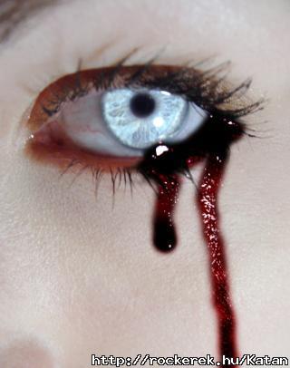 Bloody white eye