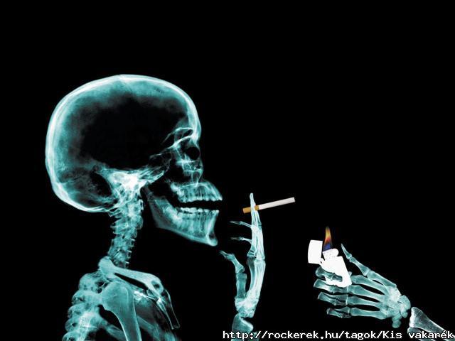 Cigit..