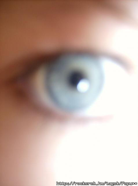 My Eye