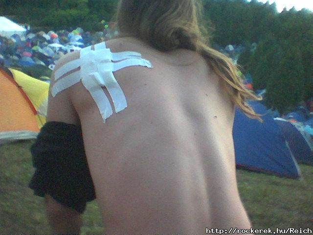 Egy apr baleset minden maratonra jut... Rockm...2010