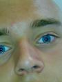 20080529176