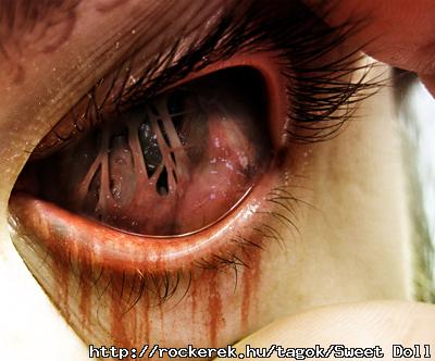eyegross1