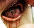 eyegross1