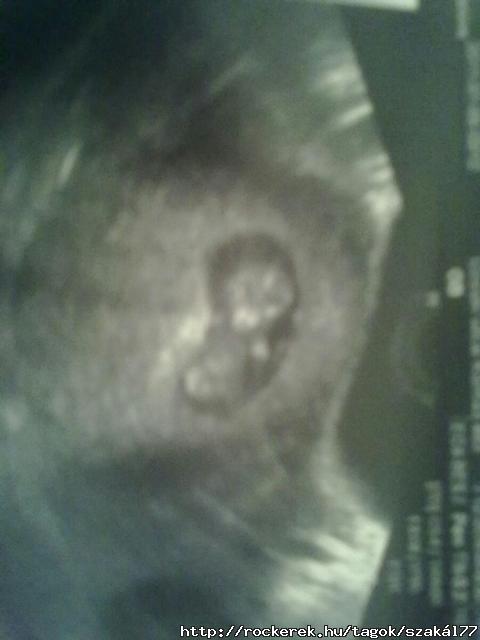 Nem az nem egy alien :)