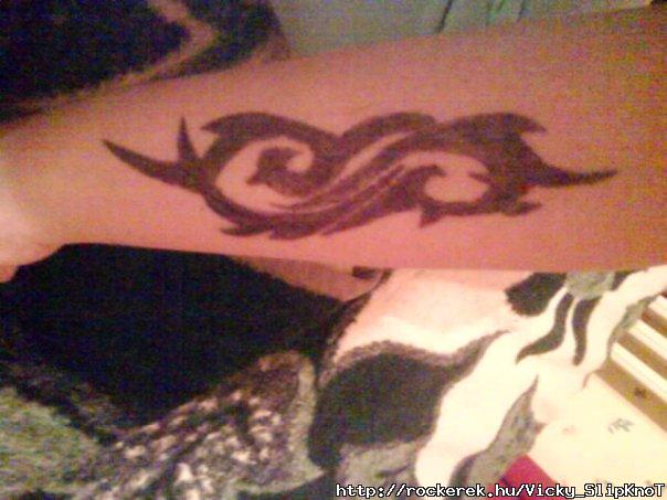 my arm