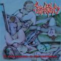 Craniotomy - It